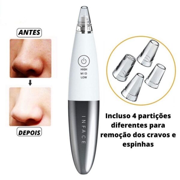 Power Acne - Potente Removedor de Cravos e Espinhas - Loja Oficial | XploudShop