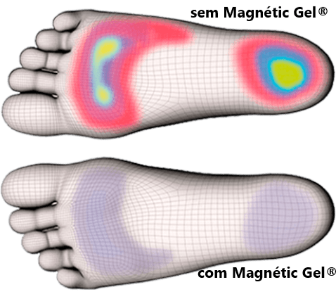 Magnétic Gel®- Palmilha Ortopédica - Loja Oficial | XploudShop